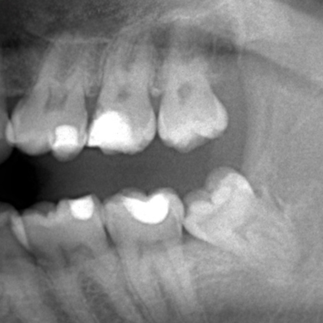 Oral surgery