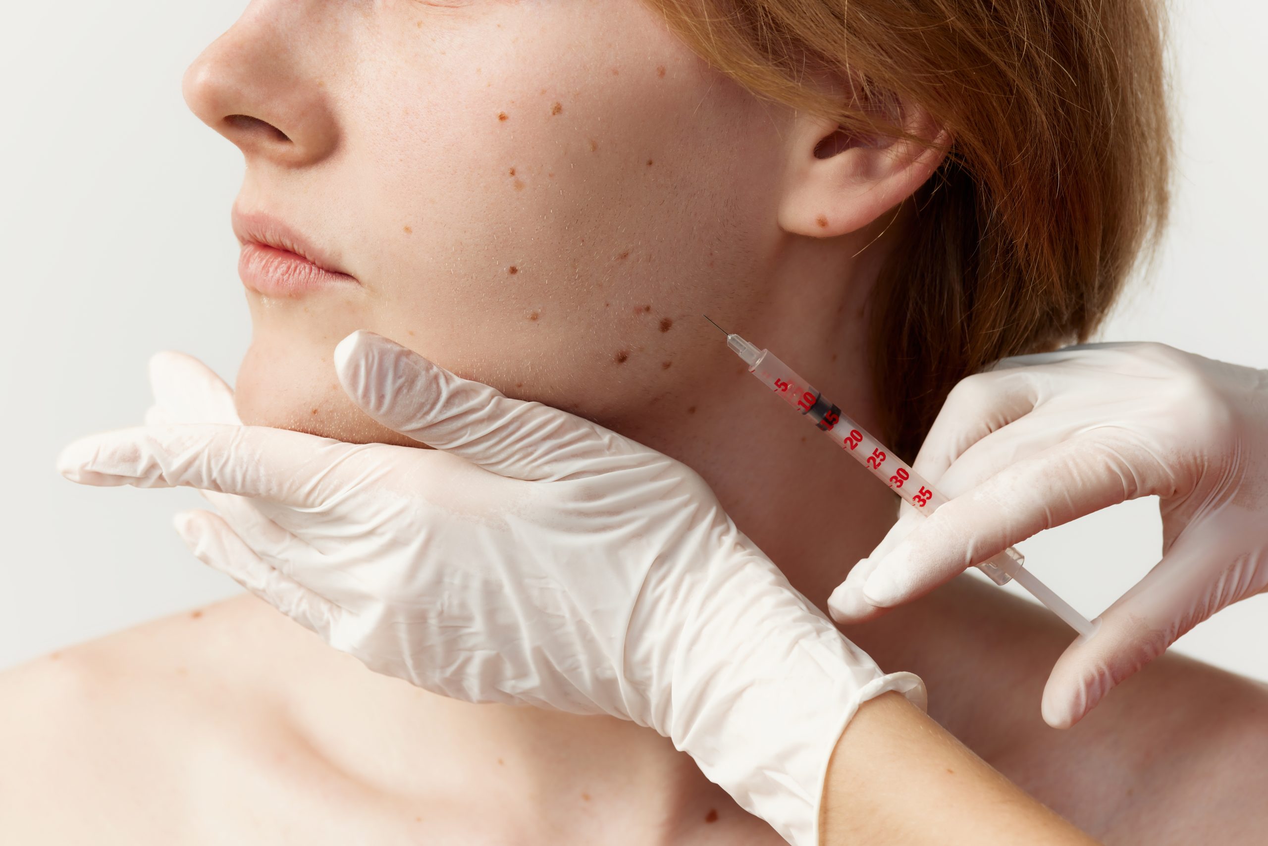 can botox help facial pain?